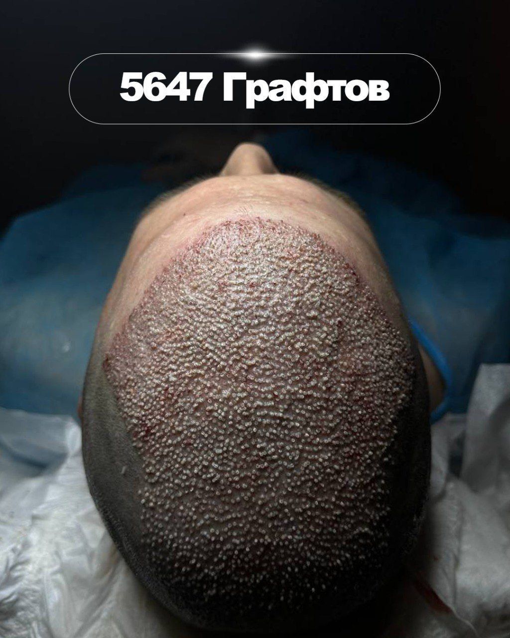 Результат через 1 год - фото 6