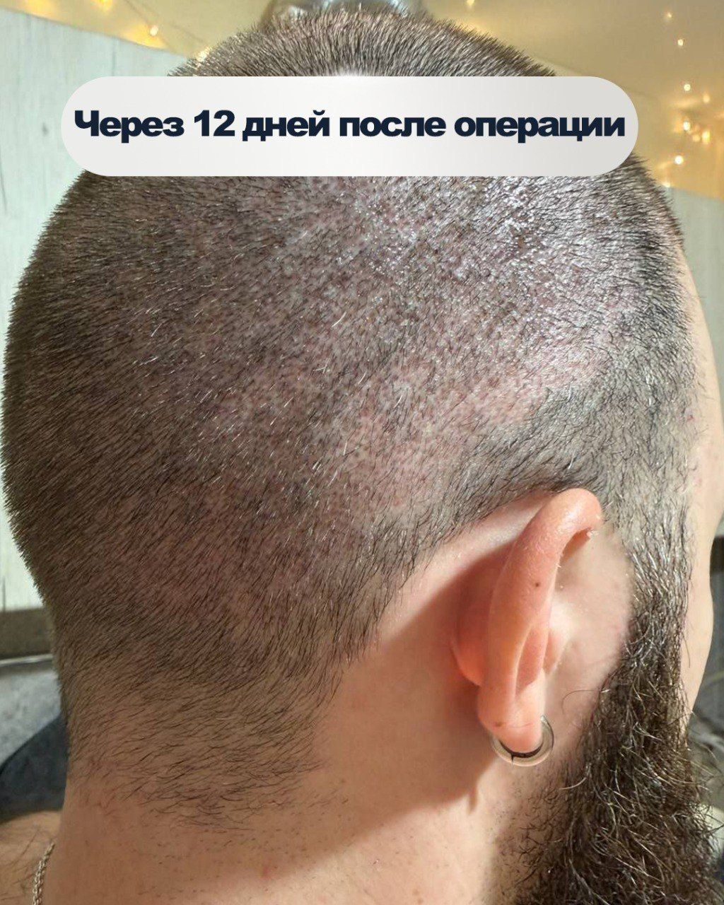 Результат через 1 год - фото 5